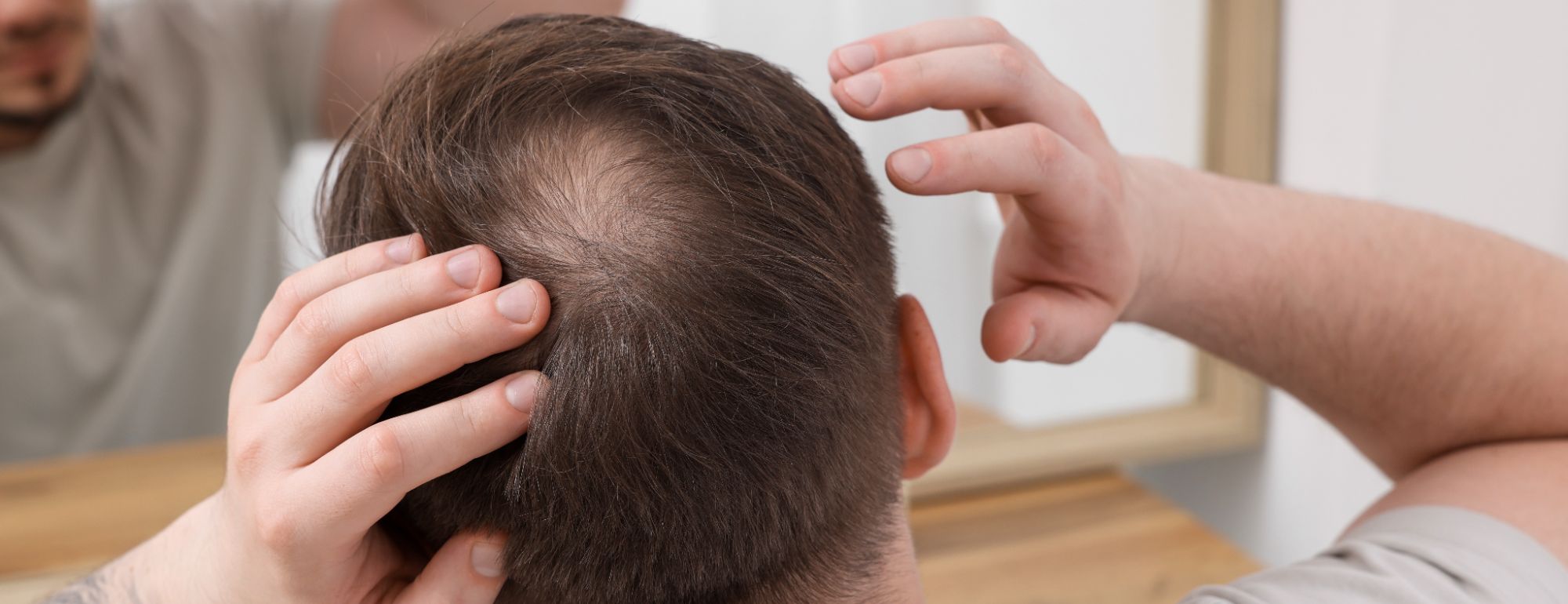 Alopecia emocional: como é que o stress e a ansiedade podem afetar a saúde capilar?